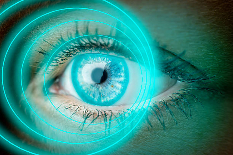 Avaliação de Filme Lacrimal Agendar Bela Vista - Diagnóstico de Olho Seco