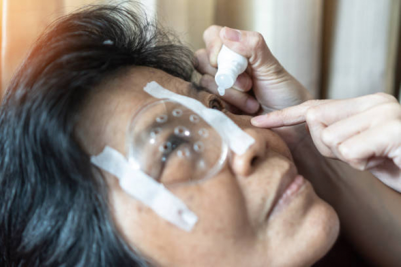 Cirurgia Catarata Laser Preço Bela Vista - Cirurgia no Olho Catarata