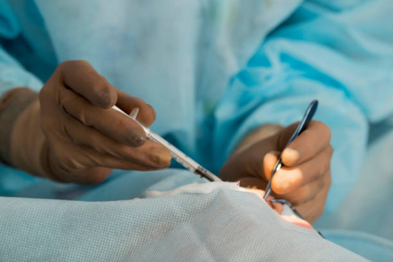 Cirurgia Catarata Ipiranga - Cirurgia de Catarata com Implante de Lente Premium