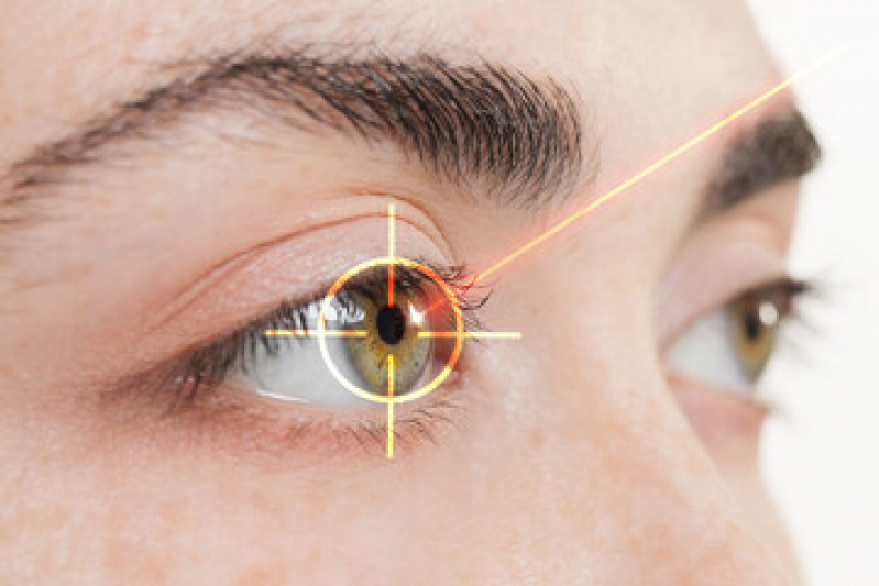 Cirurgia de Correção de Grau Valores Moema - Cirurgia a Laser nos Olhos