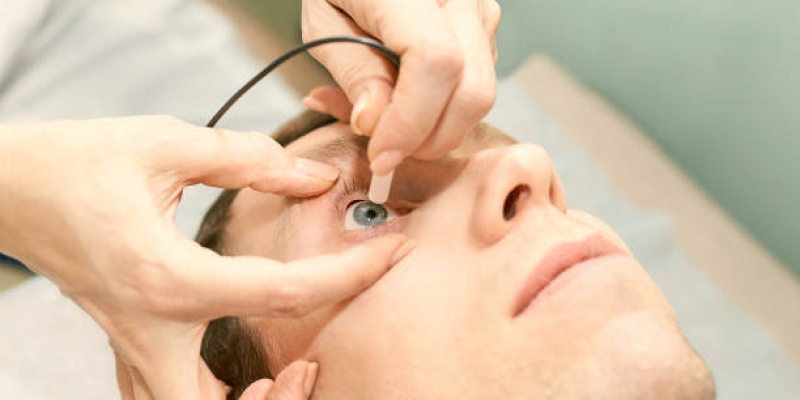 Cirurgia de Correção de Miopia Glicério - Cirurgia a Laser nos Olhos
