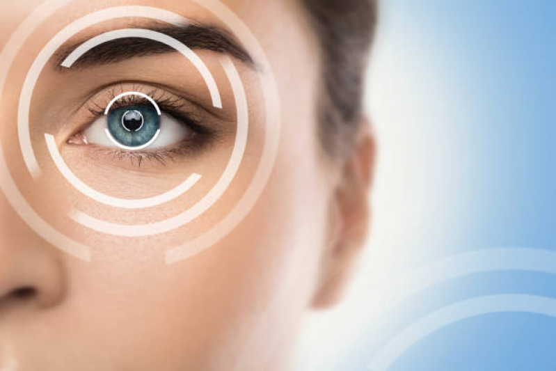 Cirurgia de Correção Miopia Valores Higienópolis - Cirurgia a Laser nos Olhos