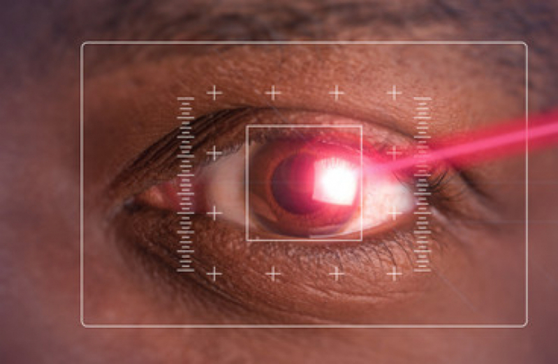 Cirurgia de Miopia e Astigmatismo Valores Centro - Cirurgia a Laser nos Olhos