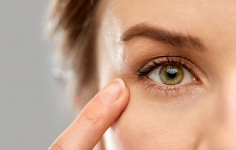 Cirurgia de Plástica Ocular Bixiga - Cirurgia Plástica Ocular para Deformações da Palpebra