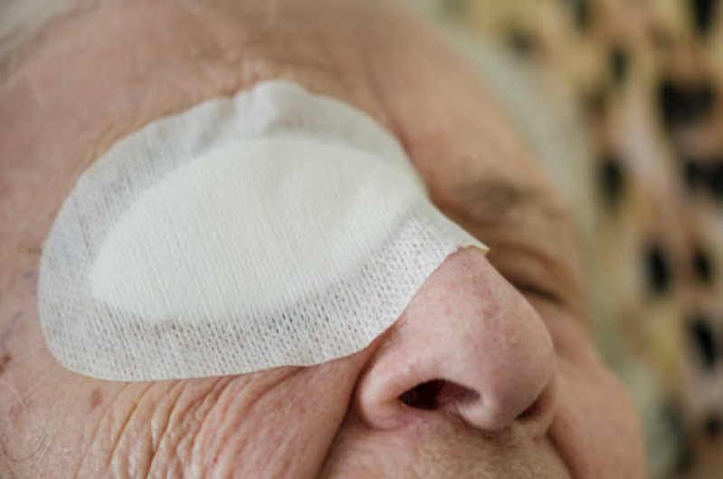 Cirurgia no Olho Catarata Preço Aricanduva - Facectomia