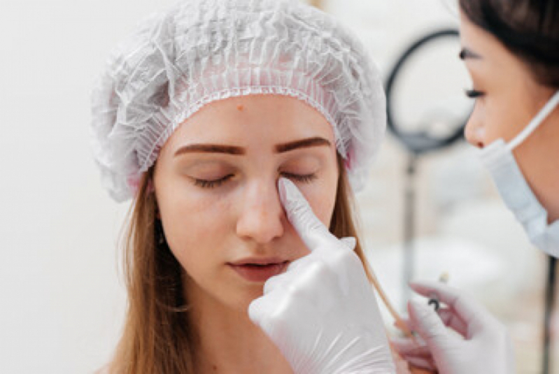 Cirurgia Plástica nos Olhos Pacaembu - Cirurgia Plástica Ocular Blefaroplastia