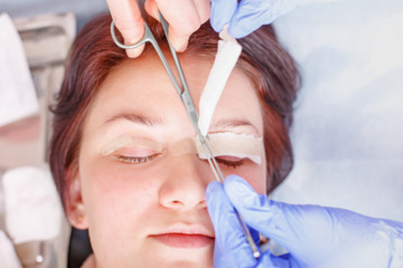 Cirurgia Plástica Ocular Valores Tatuapé - Cirurgia Plástica Ocular para Deformações da Palpebra