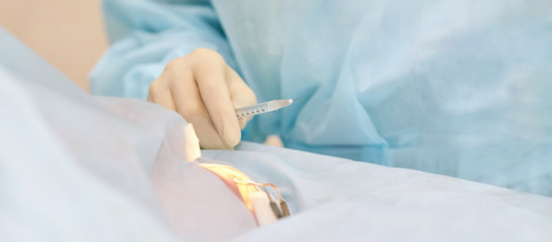 Cirurgia Plástica Oftalmológica Valores Trianon Masp - Cirurgia Plástica nos Olhos