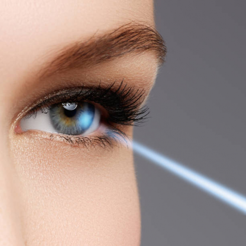 Cirurgia Refrativa Jockey Club - Cirurgia a Laser nos Olhos