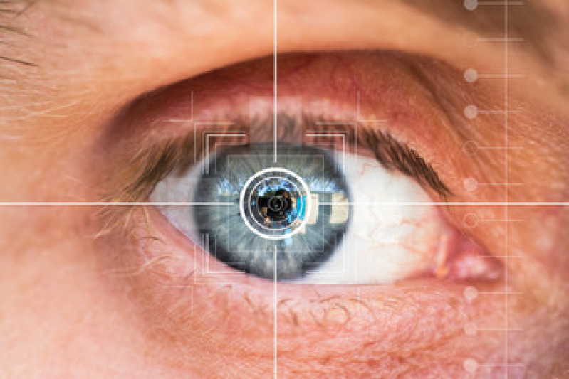 Exame de Filme Lacrimal Agendar Saúde - Diagnóstico de Olho Seco