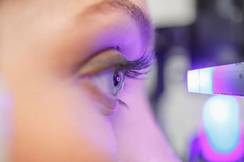 Exame de Glaucoma ângulo Fechado Itaquera - Tratamento para Glaucoma Secundário