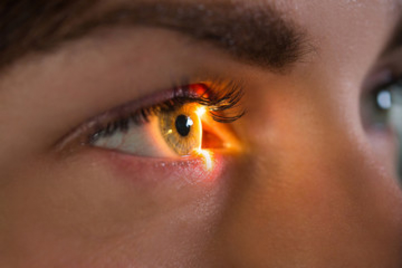 Mapeamento de Retina Glaucoma Agendar Real Parque - Mapeamento de Retina Fundo de Olho