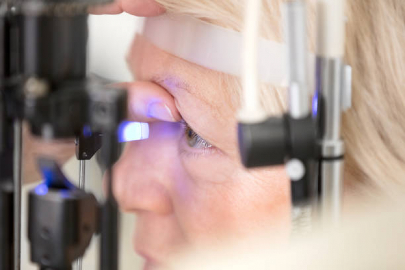 Medida de Pressão Intraocular Teste de Sobrecarga Hidrica Glicério - Medida de Pressão Ocular Alterada