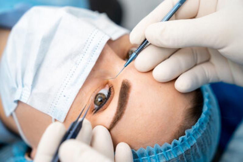 Onde Faz Cirurgia de Plástica Ocular Aeroporto - Cirurgia Plástica Ocular para Deformações da Palpebra