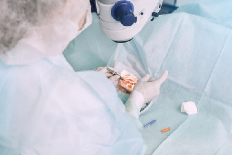 Onde Fazer Tratamento de Calázio Penha - Cirurgia de Pterígio com Transplante de Conjuntiva