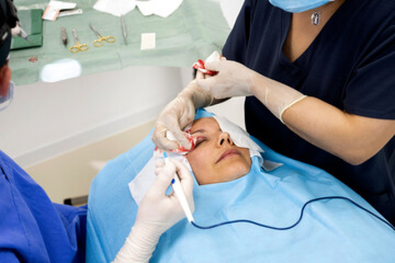 Preço de Cirurgia Plástica Ocular para Tumores da Paplebra Higienópolis - Cirurgia Plástica nos Olhos