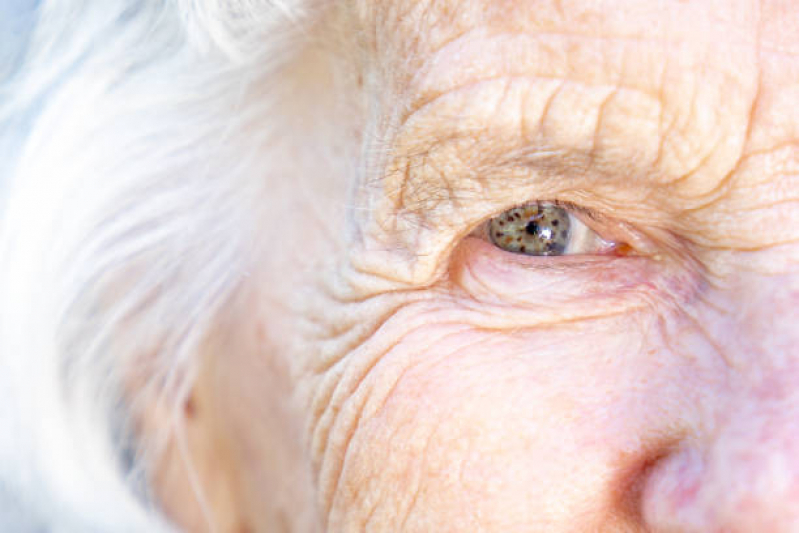 Preço de Degeneração Macular Cirurgia Ocular Av Angélica - Degeneração Macular Relacionada à Idade