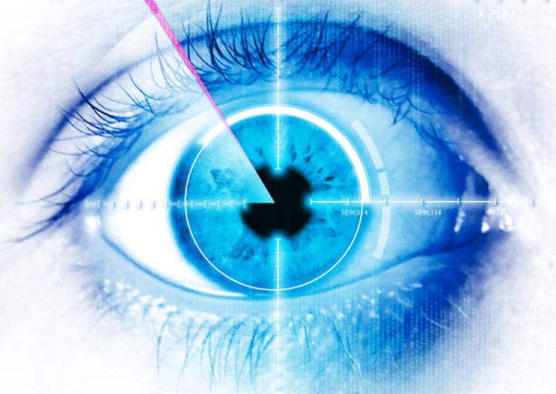 Preço de Transplante Ocular Completo Região Central - Transplante Ocular Completo