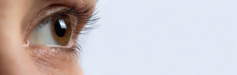 Preço de Transplante Ocular Vila Carmosina - Transplante de Córnea Particular