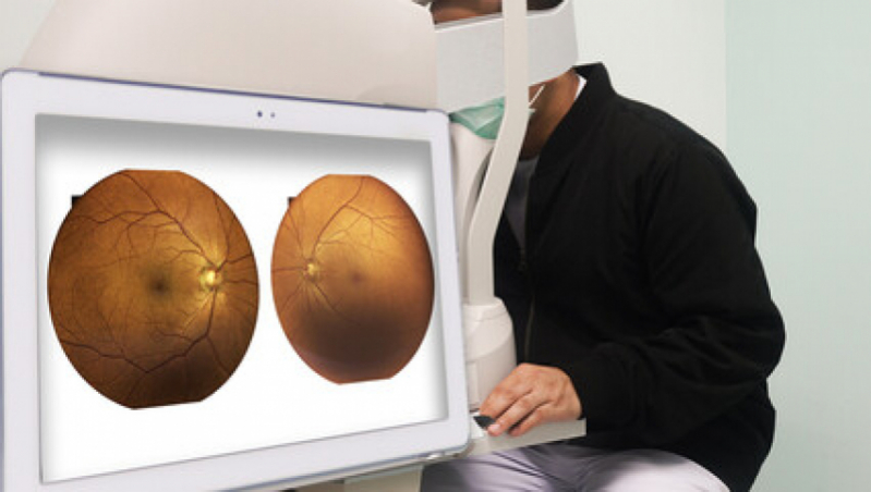 Retinopatia Diabética Tratamento a Laser Vila Andrade - Retinopatia Diabética Fundo de Olho