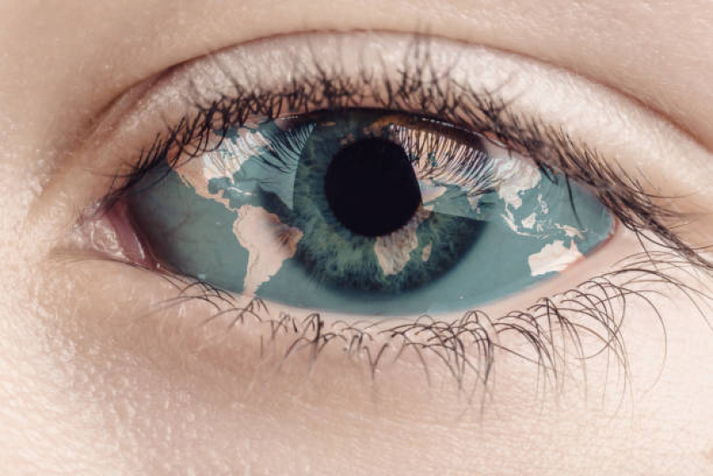 Teste de Verde Lisamina Marcar Vila Gumercindo - Exames de Olho Seco