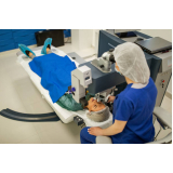 Cirurgia de Catarata com Implante de Lente Premium