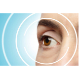 Cirurgia a Laser nos Olhos