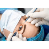 onde faz cirurgia plástica ocular Penha de França