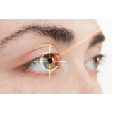 onde fazer cirurgia a laser nos olhos Chácara Flora