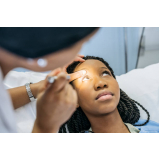 onde fazer consulta em oftalmologia Cerqueira César