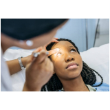 onde marcar consulta com o oftalmologista Saúde
