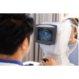 preço de biometria ultrassônica cálculo da lente intraocular Vila Carmosina