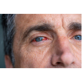 retinopatia diabética fundo de olho tratamento Augusta