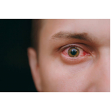retinopatia diabética fundo de olho Pompéia