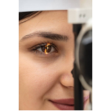 tratamento de córnea dos olhos Bexiga