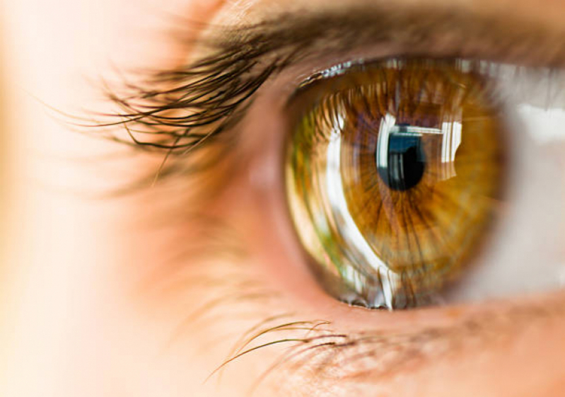 Transplante de Córnea Ceratocone Valores Itaim Bibi - Transplante Ocular Completo