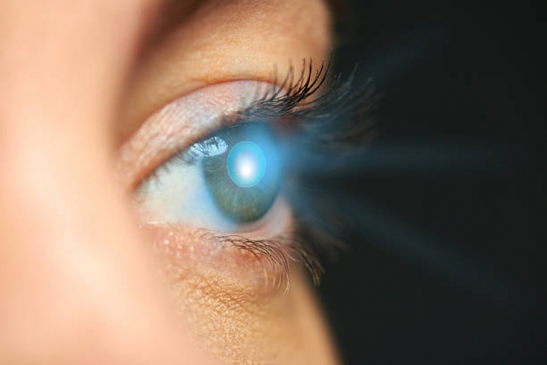 Transplante de Córnea Especial Valores Sacomã - Transplante Ocular Completo