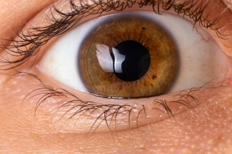 Transplante Ocular Preços Butantã - Transplante de Córnea Particular Especial