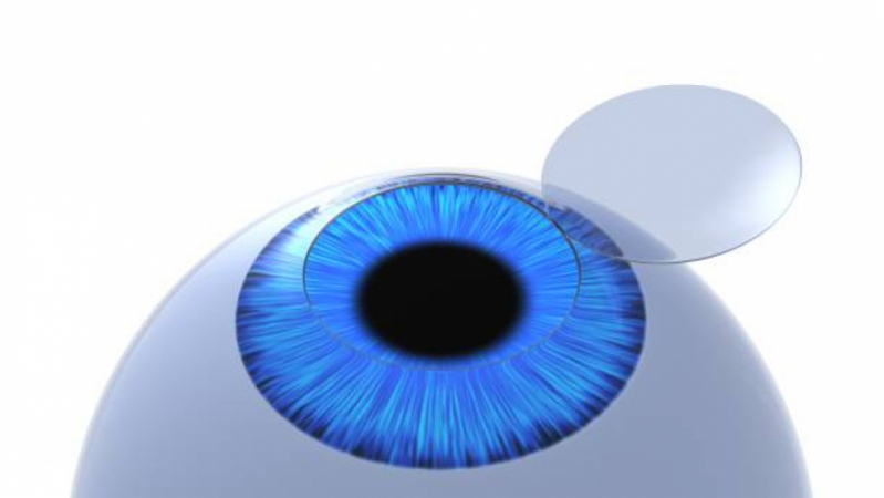 Transplante Ocular Vergueiro - Transplante de Córnea