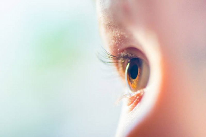 Tratamento de Córnea do Olho Inflamada Avenida Rebouças - Tratamento de Córnea