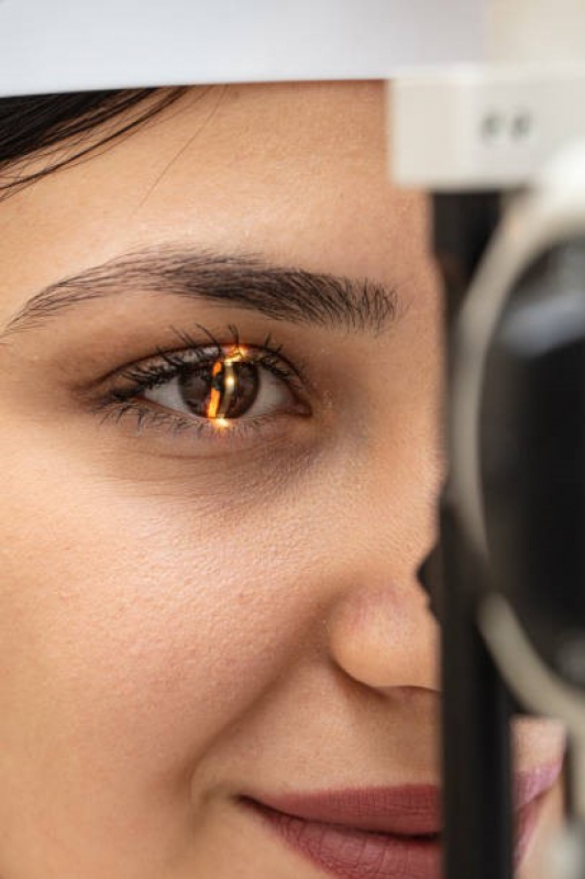 Tratamento de Córnea dos Olhos Luz - Tratamento de Córnea do Olho Danificada