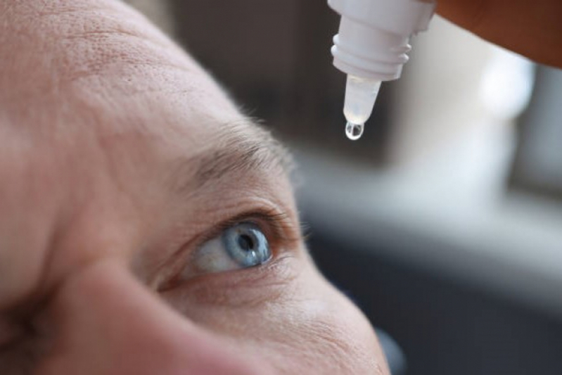 Tratamentos de Córnea Aricanduva - Tratamento de Córnea Herpes Ocular
