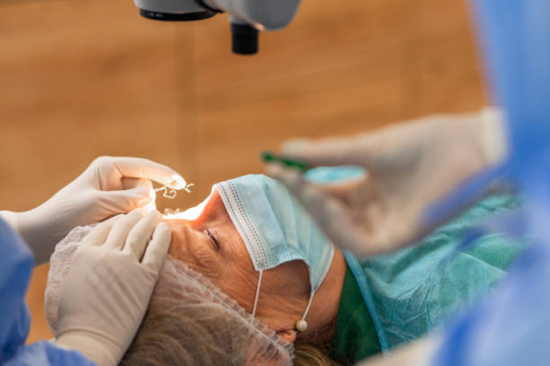 Valor de Cirurgia Catarata a Laser Vila Nova Conceição - Cirurgia no Olho Catarata