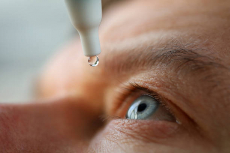 Valor de Glaucoma de ângulo Fechado Cerqueira César - Tratamento para Glaucoma Secundário