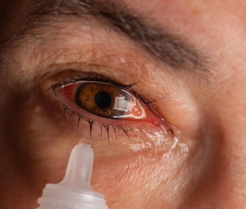 Valor de Retinopatia Diabética Fundo de Olho Chácara Inglesa - Retinopatia Diabética Tratamento com Injeção Intravítrea