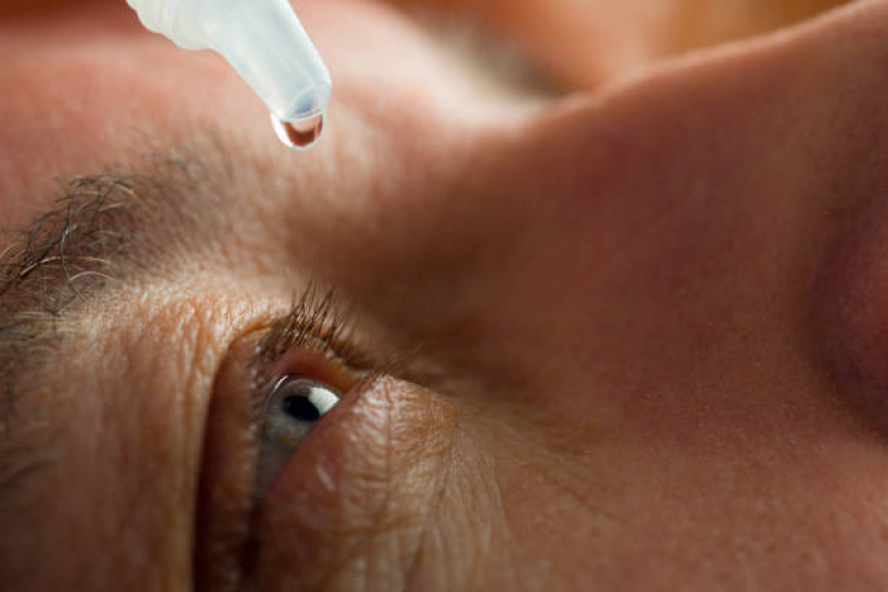 Valor de Tratamento para Glaucoma Secundário Paraíso - Glaucoma de ângulo Fechado